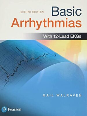 Basic Arrhythmias