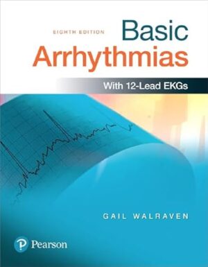Basic Arrhythmias:, 8th Edition