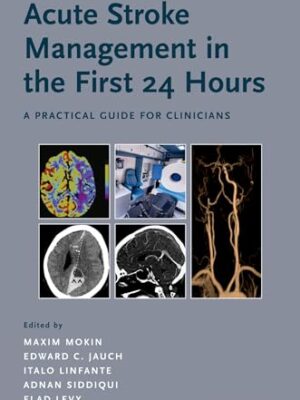 Acute stroke Management In The First 24 Hours: A Practical Guide For Clinicians