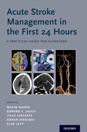 Acute stroke Management In The First 24 Hours: A Practical Guide For Clinicians