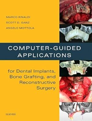 Computer-Guided Applications For Dental Implants, Bone Grafting, And Reconstructive Surgery 1st Edition