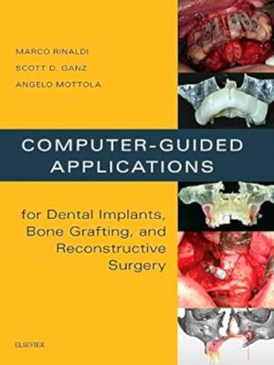 Computer-Guided Applications For Dental Implants, Bone Grafting, And Reconstructive Surgery 1st Edition