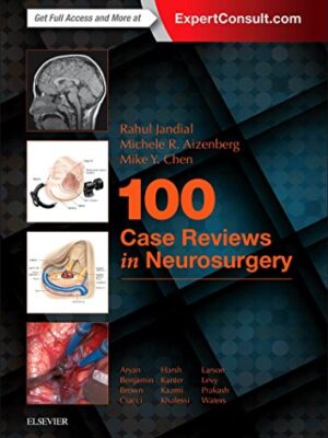 100 Case Reviews In Neurosurgery