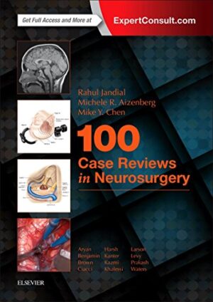 100 Case Reviews In Neurosurgery