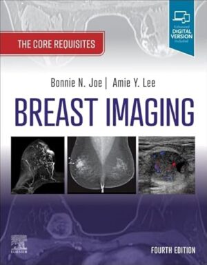 Breast Imaging: The Core Requisites 4th Edition
