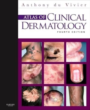 Atlas Of Clinical Dermatology Illustrated