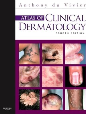 Atlas Of Clinical Dermatology Illustrated