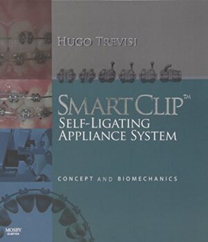 Smartclip Self-ligating Appliance System: Concept And Biomechanics 1st Edition