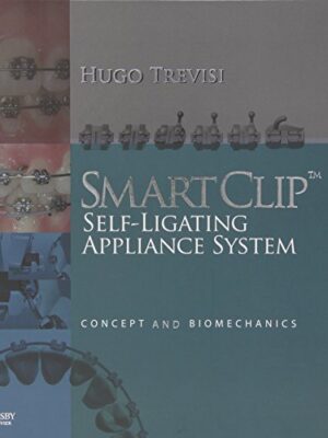 Smartclip Self-ligating Appliance System: Concept And Biomechanics 1st Edition
