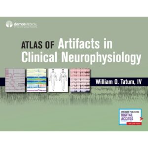 Atlas of Artifacts in Clinical Neurophysiology