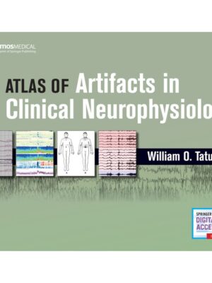 Atlas of Artifacts in Clinical Neurophysiology