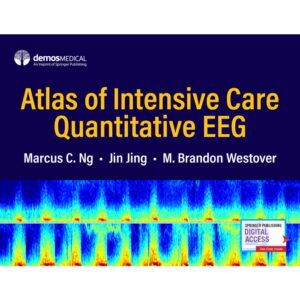 Atlas of Intensive Care Quantitative EEG