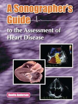 A Sonographer's Guide To The Assessment Of Heart Disease