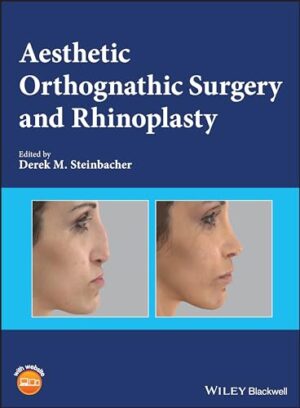 Aesthetic Orthognathic Surgery And Rhinoplasty 1st Edition