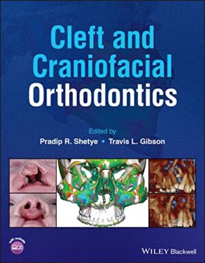 Cleft And Craniofacial Orthodontics 1st Edition