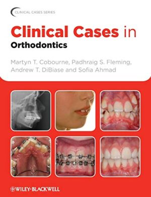 Clinical Cases In Orthodontics