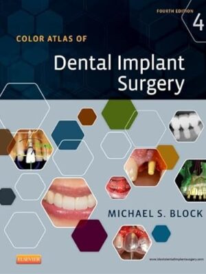 Color Atlas Of Dental Implant Surgery 4th Edition