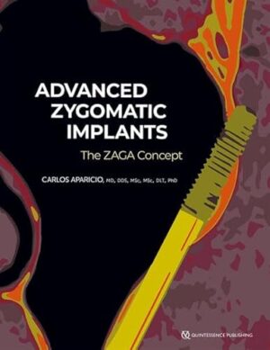 Advanced Zygomatic Implants: The Zaga Concept 1st Edition