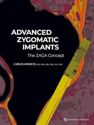 Advanced Zygomatic Implants: The Zaga Concept 1st Edition