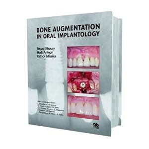 Bone Augmentation In Oral Implantology 1st Edition