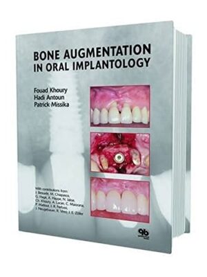 Bone Augmentation In Oral Implantology 1st Edition
