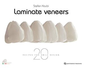 Laminate Veneers: 20 Recipes For Smile Design