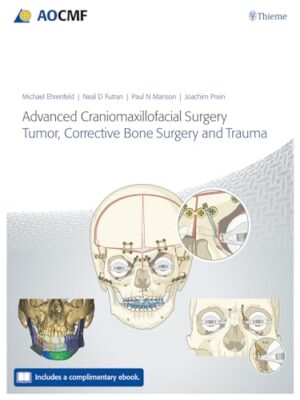 Advanced Craniomaxillofacial Surgery: Tumor, Corrective Bone Surgery, and Trauma 1st Edition