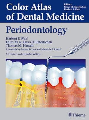 Color Atlas Of Dental Medicine: Periodontology 3rd Revised And Expanded Edition