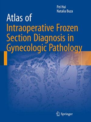Atlas Of Intraoperative Frozen Section Diagnosis In Gynecologic Pathology 1st Edition
