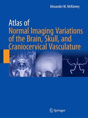 Atlas Of Normal Imaging Variations Of The Brain, Skull, And Craniocervical Vasculature 1st Edition