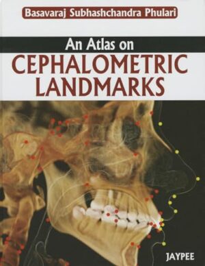 An Atlas On Cephalometric Landmarks 1st Edition